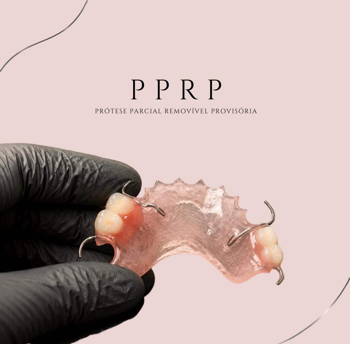 Prótese parcial removível provisória